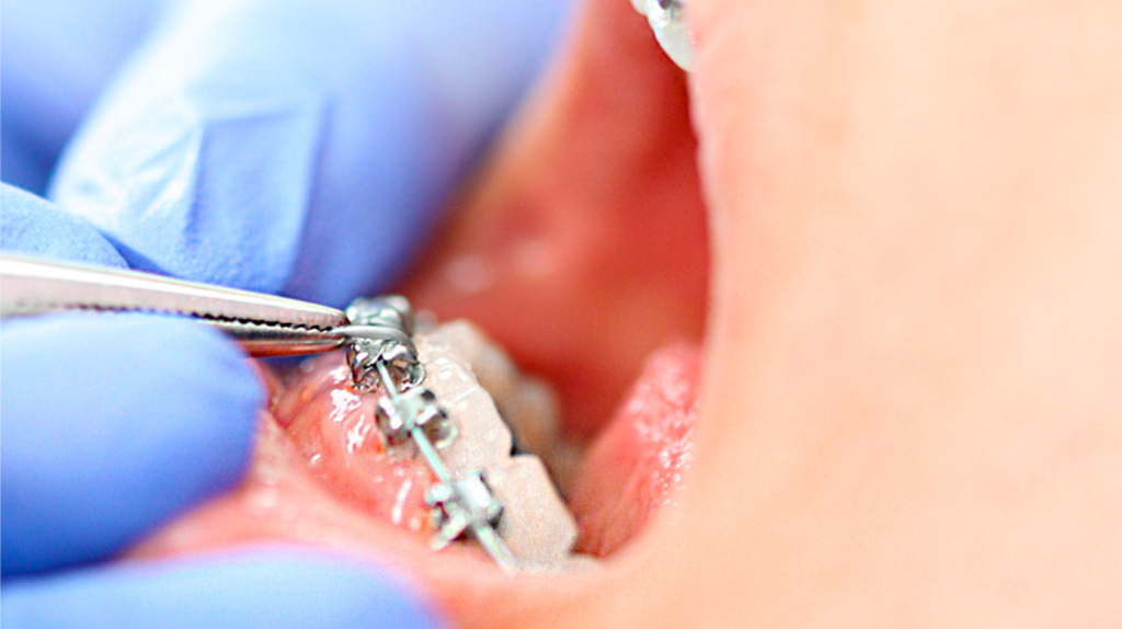 Conseils d&rsquo;hygiène