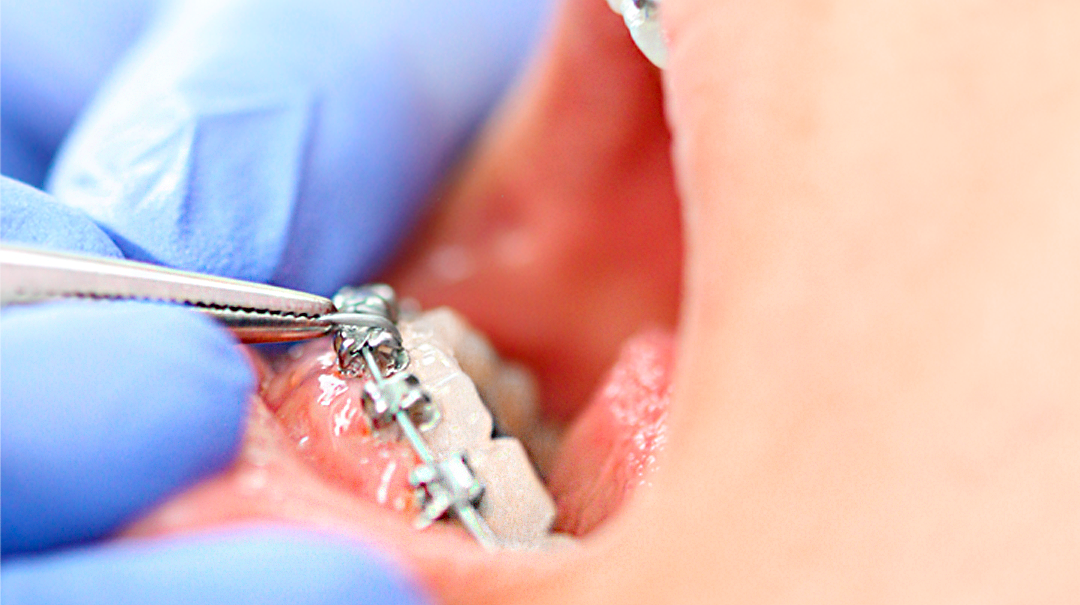 Conseils d&rsquo;hygiène