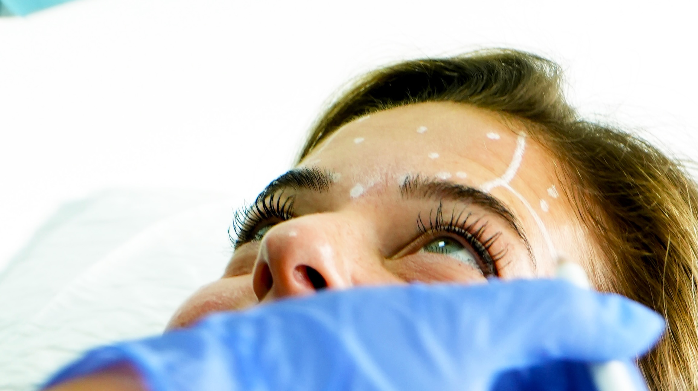 Facial harmonisation