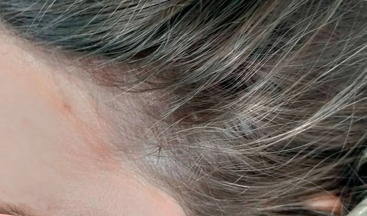 Antes